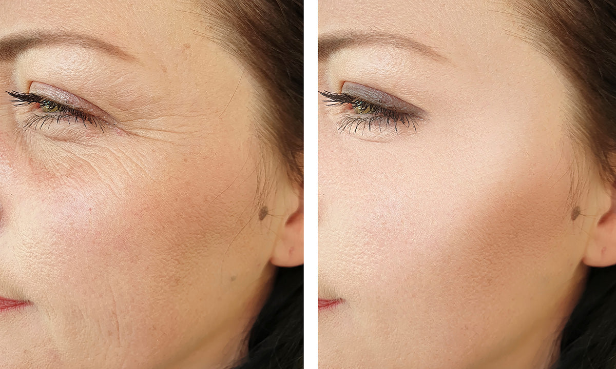 Reduce fine lines & wrinkles