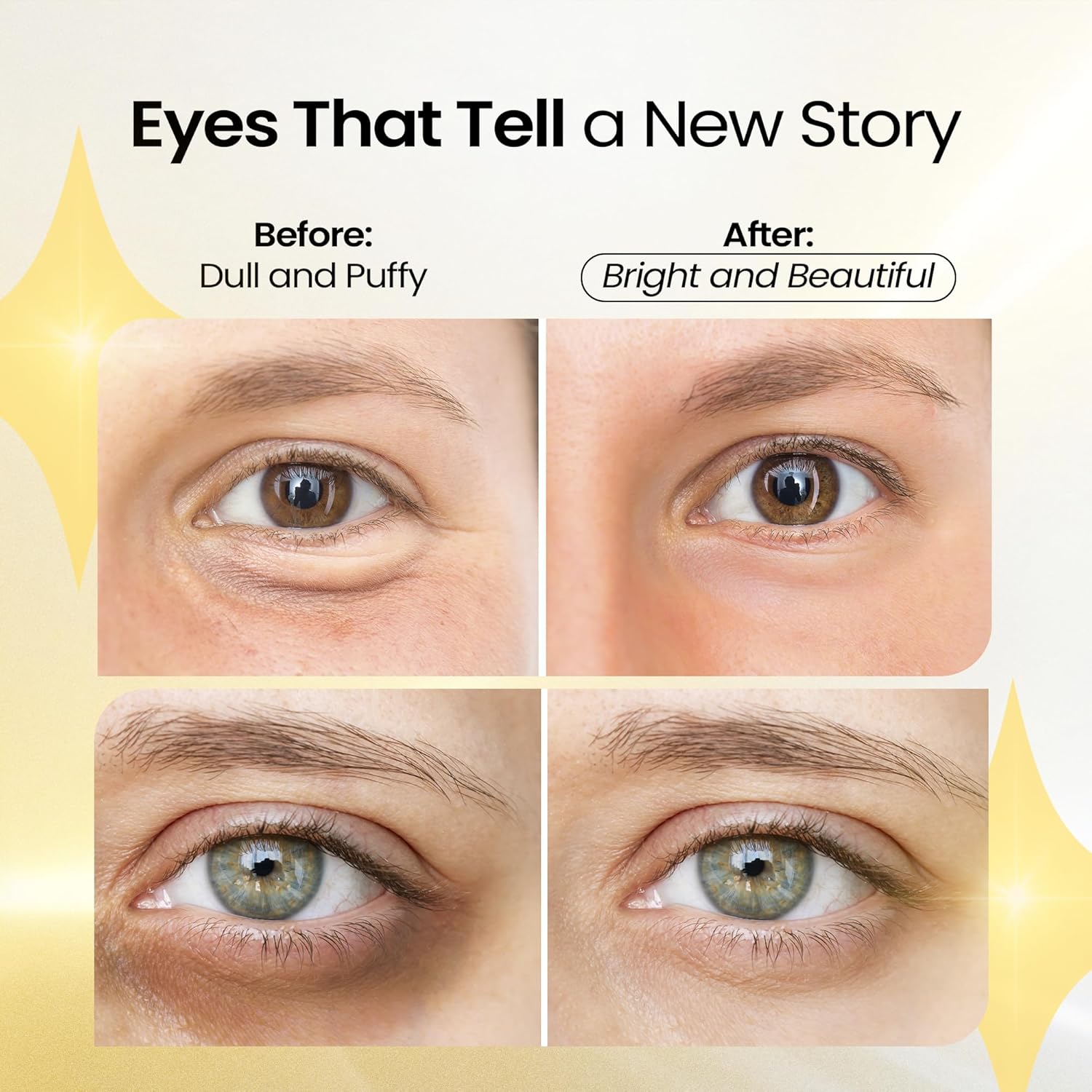 Before and after comparison